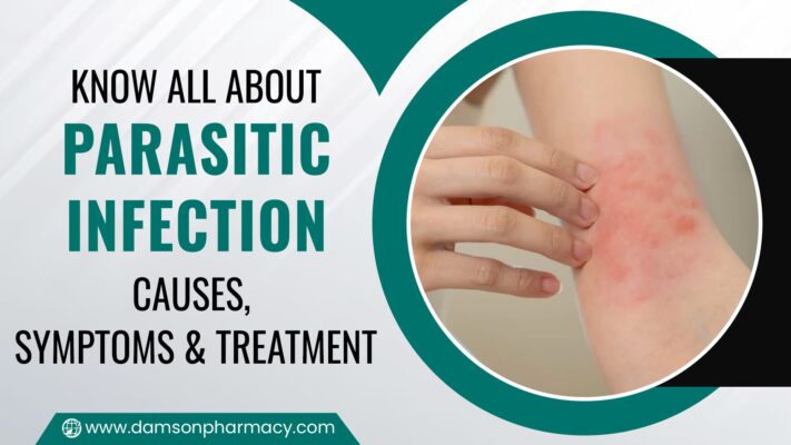 Know All About Parasitic Infection: Causes, Symptoms & Treatment